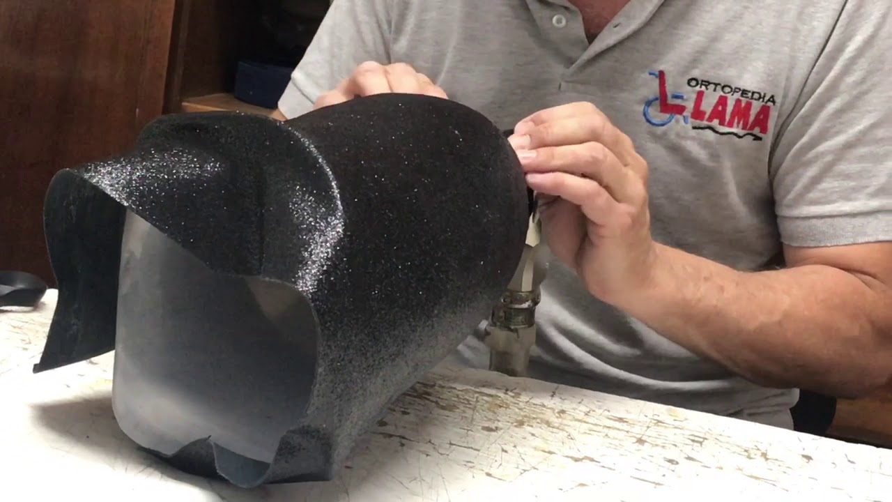 ME CAMBIO EL COLOR DE MI PIERNA - Juana Rodríguez Abadie