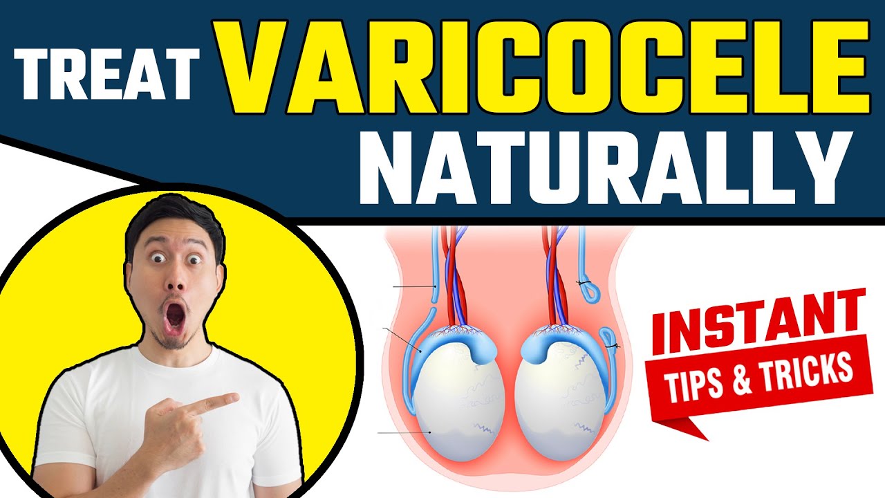 Homeopathic Treatment for Varicocele: An Effective Solution for Symptom  Relief, by bharat homeopathy