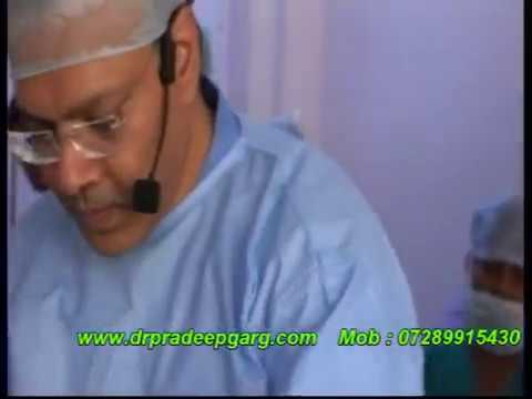Laparoscopic  Sacrocolpopexy For Vaginal Vault Prolapse With Prolene Mesh Dr Pradeep Garg