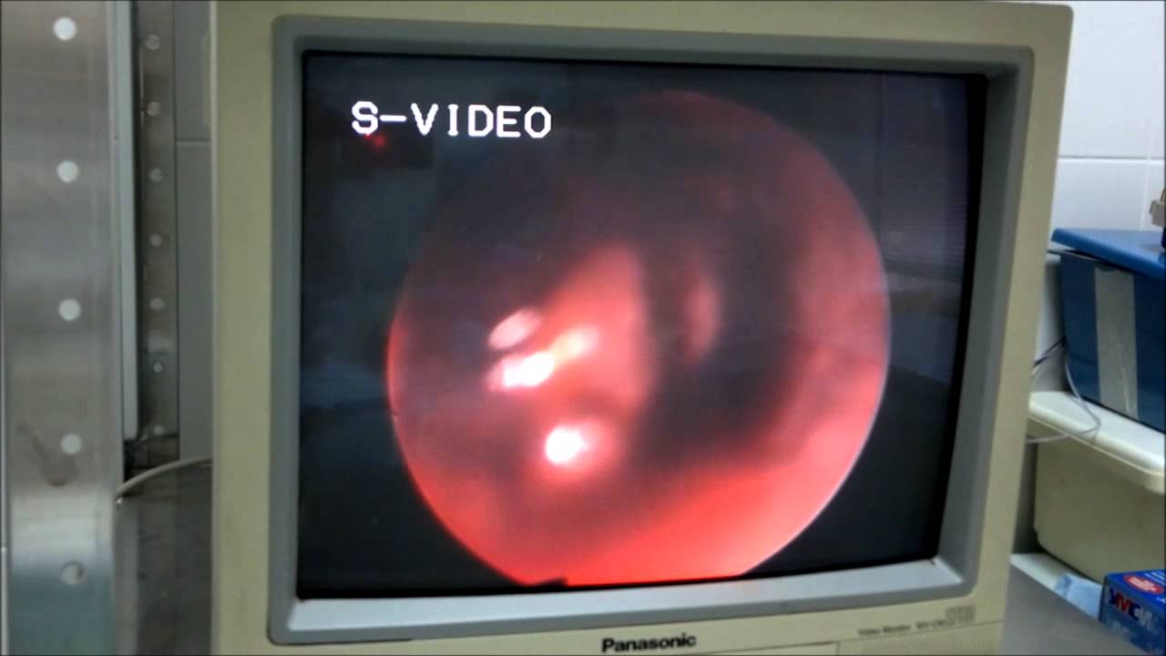 Отоскопия / otoscopy - YouTube