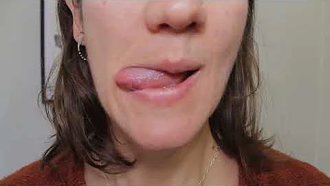 5 Minute Tongue Exercises for Speech and Swallowing