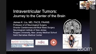 Intraventricular Tumors with James Liu MD  SERIES#1 screenshot 2