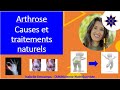 Arthrose  causes et traitements naturels