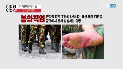 엄 여인의 범행 수법, 안와 봉와직염 / YTN 라이프