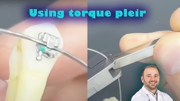 Apply torque for single tooth on orthodontic wire with torque pliers, change tipping of single tooth