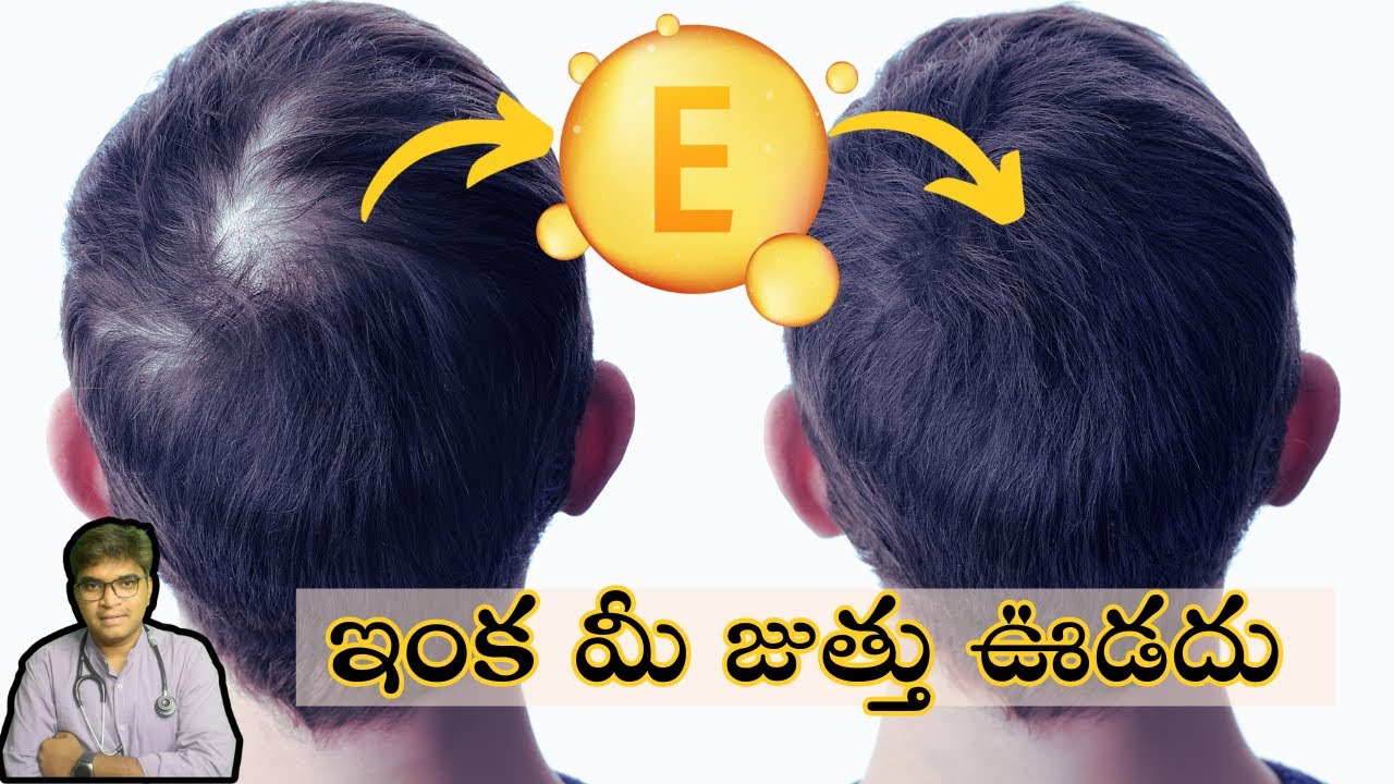 Unlocking the Secrets: The Role of Vitamin E in Hair Growth