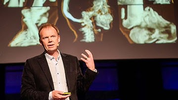 Visualizing the medical data explosion - Anders Ynnerman