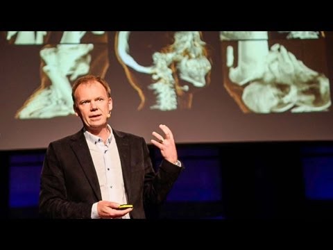 Visualizing the medical data explosion - Anders Ynnerman thumbnail