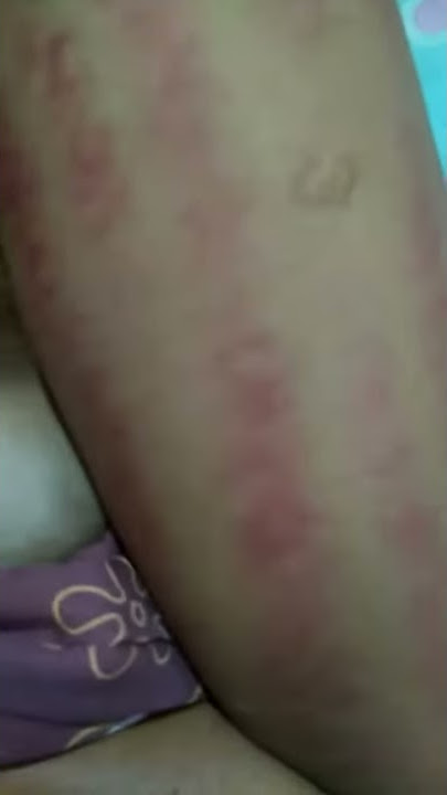 I Love You ( Kerokan Tradisional Jawa )