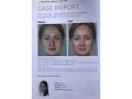 Case reports