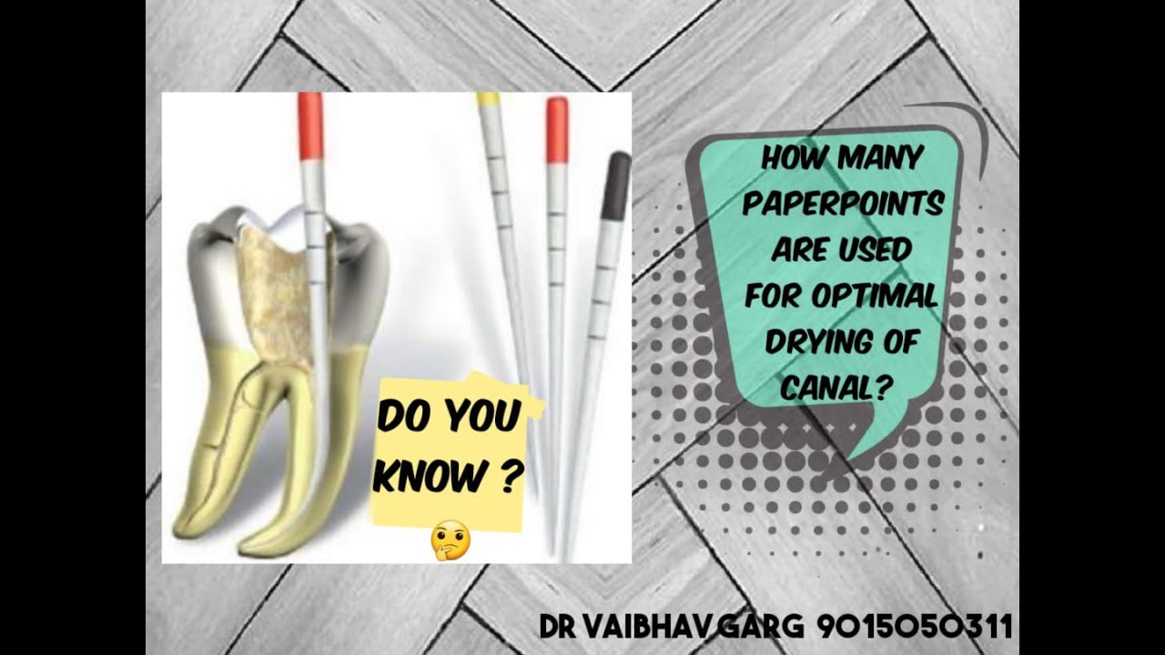 Paper Point in Endodontics Right Technique of Using YouTube