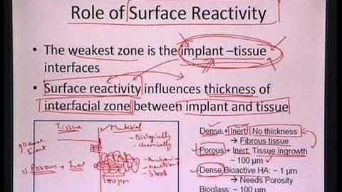 Mod-01 Lec-18  Lecture-18-Introduction to Biomaterials