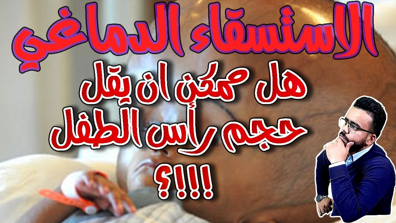 الاستسقاء الدماغي || اسبابه وطرق علاجه وما هي احتمالية الشفاء من هذا المرض واحتمالية صغر حجم الرأس