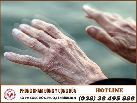 Bệnh Parkinson là gì? Nguyên nhân, triệu chứng, biến chứng cần biết