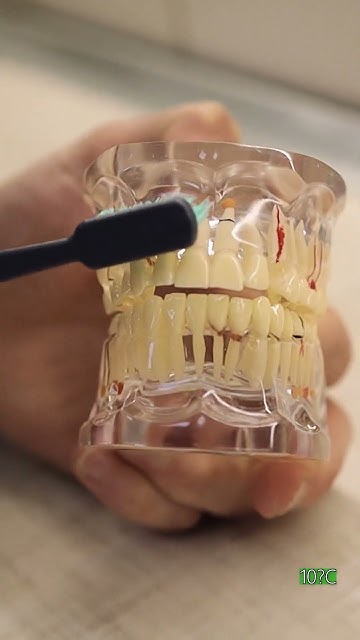 Правильна чистка зубів #клініка #dentist #топ #зуби #лікар # ...