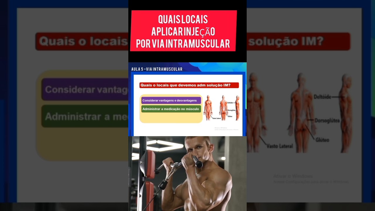 Locais De Injecao Intramuscular Quando Há Necessidade De Administrar
