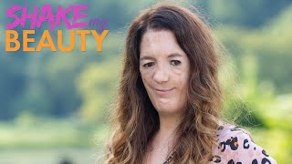 Actress With Facial Difference Redefines Beauty | SHAKE MY BEAUTY