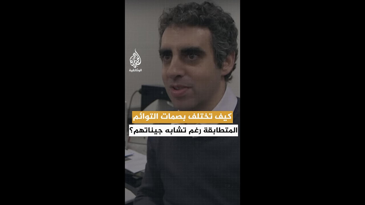 كيف تختلف بصمات التوائم المتطابقة رغم تشابه جيناتهم؟
