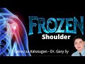 Frozen Shoulder - Dr. Gary Sy