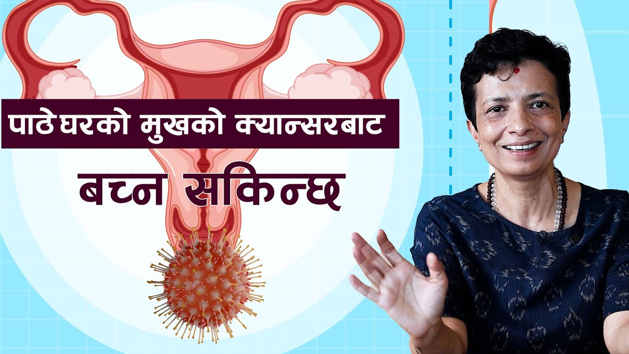 पाठेघरको मुखको क्यान्सरको 'सजिलै' रोकथाम छ !! डा. सरिता घिमिरे || NIKO NEPAL