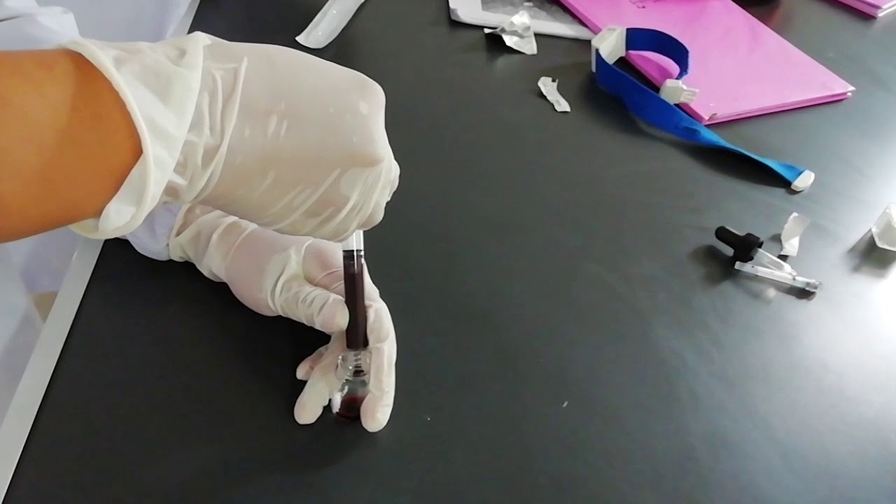 Apusan Darah Tepi Youtube