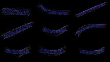 SOFA symposium 2020 - stent expansion simulation