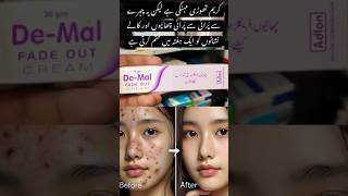 De - Mal Cream Chahre Se Chahiyan,Dane Aur Nishan Khatam Krne K Ilaj K Lie Mufed Hy