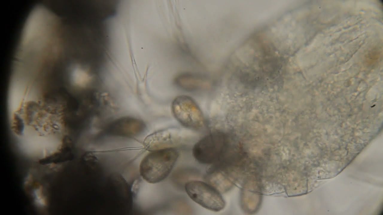 Coleps hirtus полная версия.