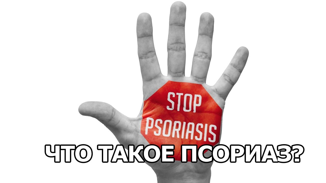 Что такое псориаз? - YouTube