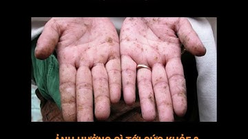 Asen ảnh hưởng thế nào đến sức khỏe