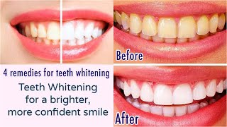 How to get Teeth whitening at home /4 Best remedies for teeth whitening | Samra Rukhsar