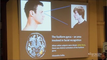 You and Your Racist Brain: The Neuroscience of Prejudice
