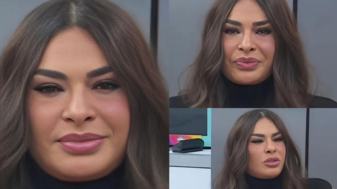 QUE le Pasó a Galilea Montijo en la Cara😱?