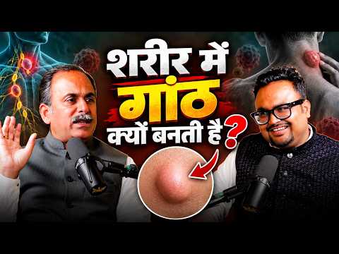चर्बी की गांठ | गांठ बनने का मुख्य कारण | Cyst Ko Kaise thik Kare | Cyst ka ilaj | Acharya Manish ji