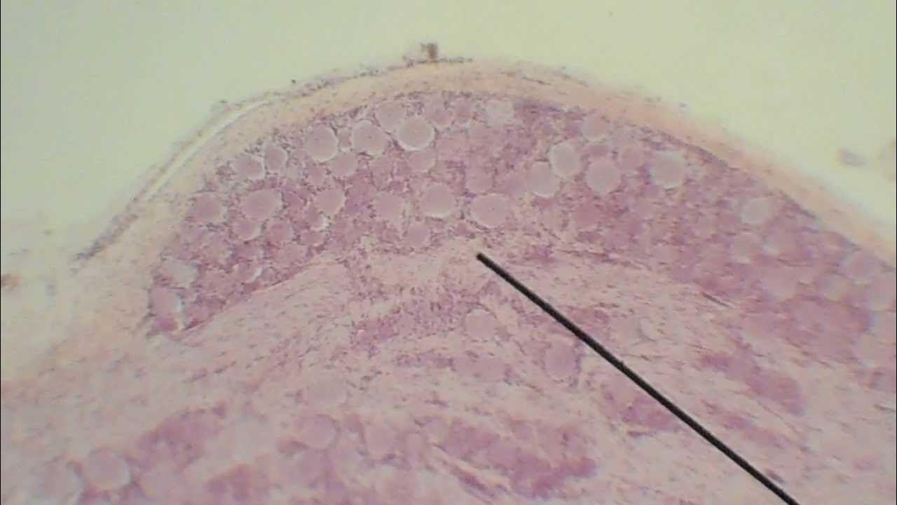 спинномозговой узел гистология. срез спинномозгового узла гистология препарат. спинальный ганглий гистология. спинномозговой ганглий препарат. спинномозговой узел гистология препарат.