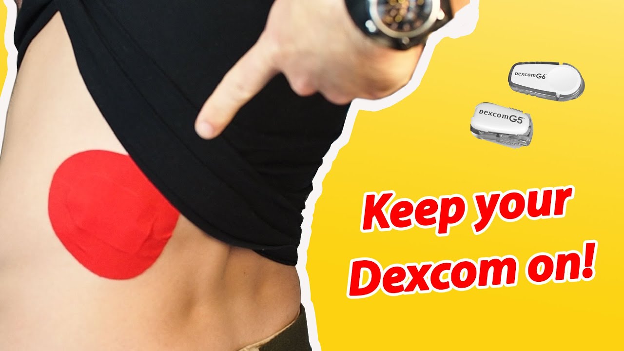 Dexcom CGM Patches