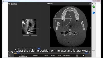 CS 9600 CBCT System – 3D imaging workflow using SmartAuto 3D