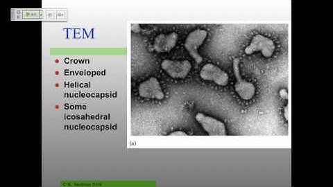 Vir_S14_L11 Coronaviruses
