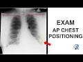 Don’t Lose Marks — AP Chest X-ray Positioning Explained