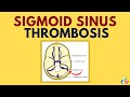 Sigmoid Sinus Thrombosis | Lateral Sinus Thrombosis (Thrombophlebitis)