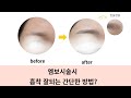엠보눈썹?  핵심은 니들끝에 묻은 색소!