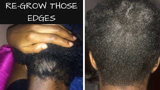 HOW TO GROW YOUR EDGES || TOLULOPE SOLUTIONS ADEJUMO