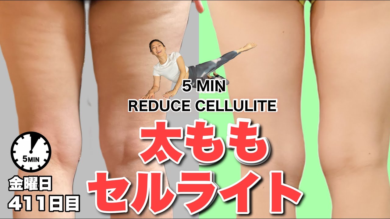 セルライト 落とし 方