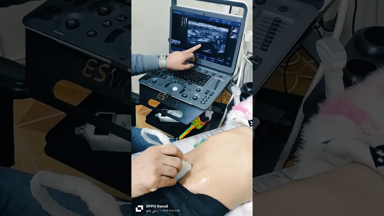 كورس سونار البطن والحوض والرئه مختصر جدا _ إتعلم سونار بسهوله