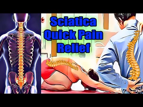 One Minute Sciatica Exercise To Cure Sciatica &amp; Fst Pain Relief | Leg Pain Sciatica Disc Bulges