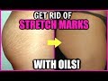 Top 5 Oils That Get Rid Of Stretch Marks! │How To Remove & Fade Stretch Marks With Essential Oils!
