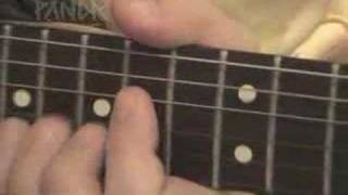 Video thumbnail of "clases de guitarra "Cita en el quirofano""