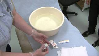 Hand eczena  using potassium permanganate soaks