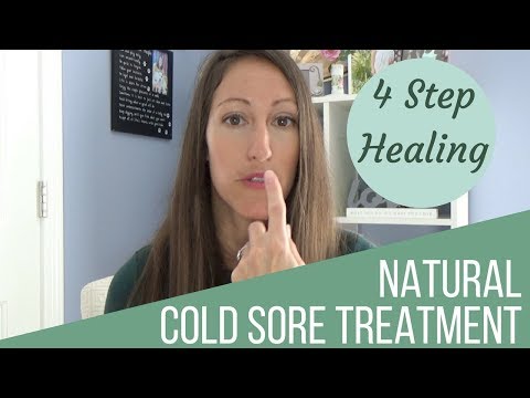 4-natural-ways-to-heal-a-cold-sore-&-cure-herpes-simplex-virus-1-&-2-fast-&-naturally!