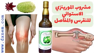 مشروب المورينزي الاستوائي للنقرس والمفاصل